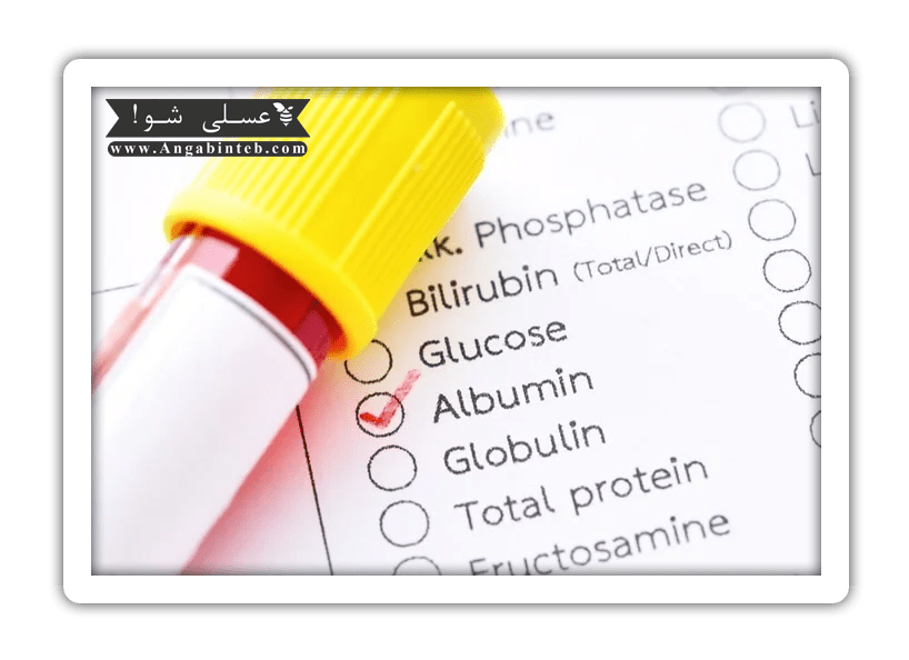 Evaluation%20of%20malnutrition-2-min.png