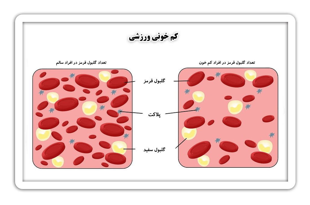 athleticanemia-signs