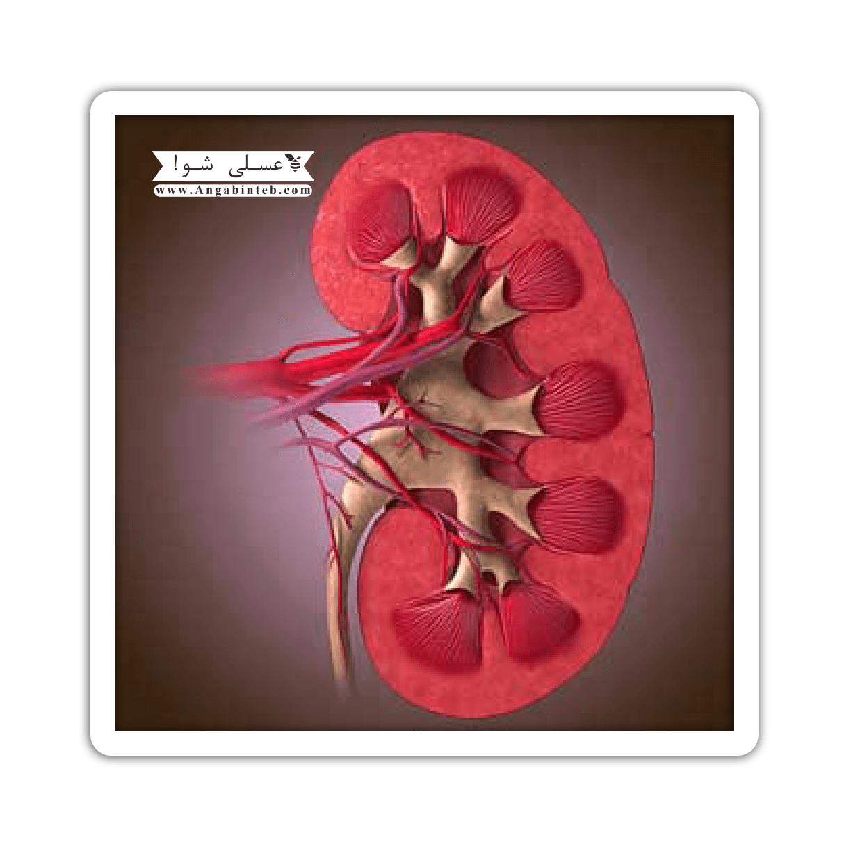 Nephrotic%20syndrome-cause