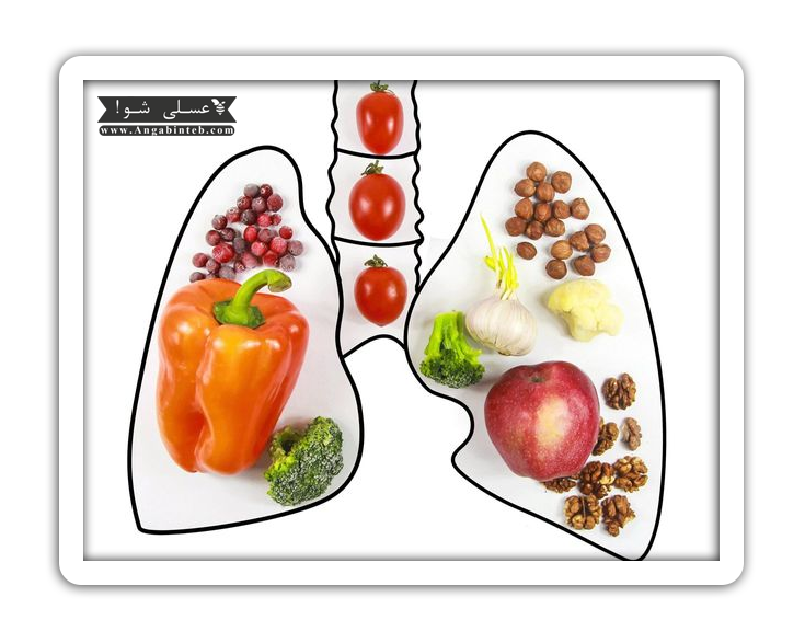 Tuberculosis-nut