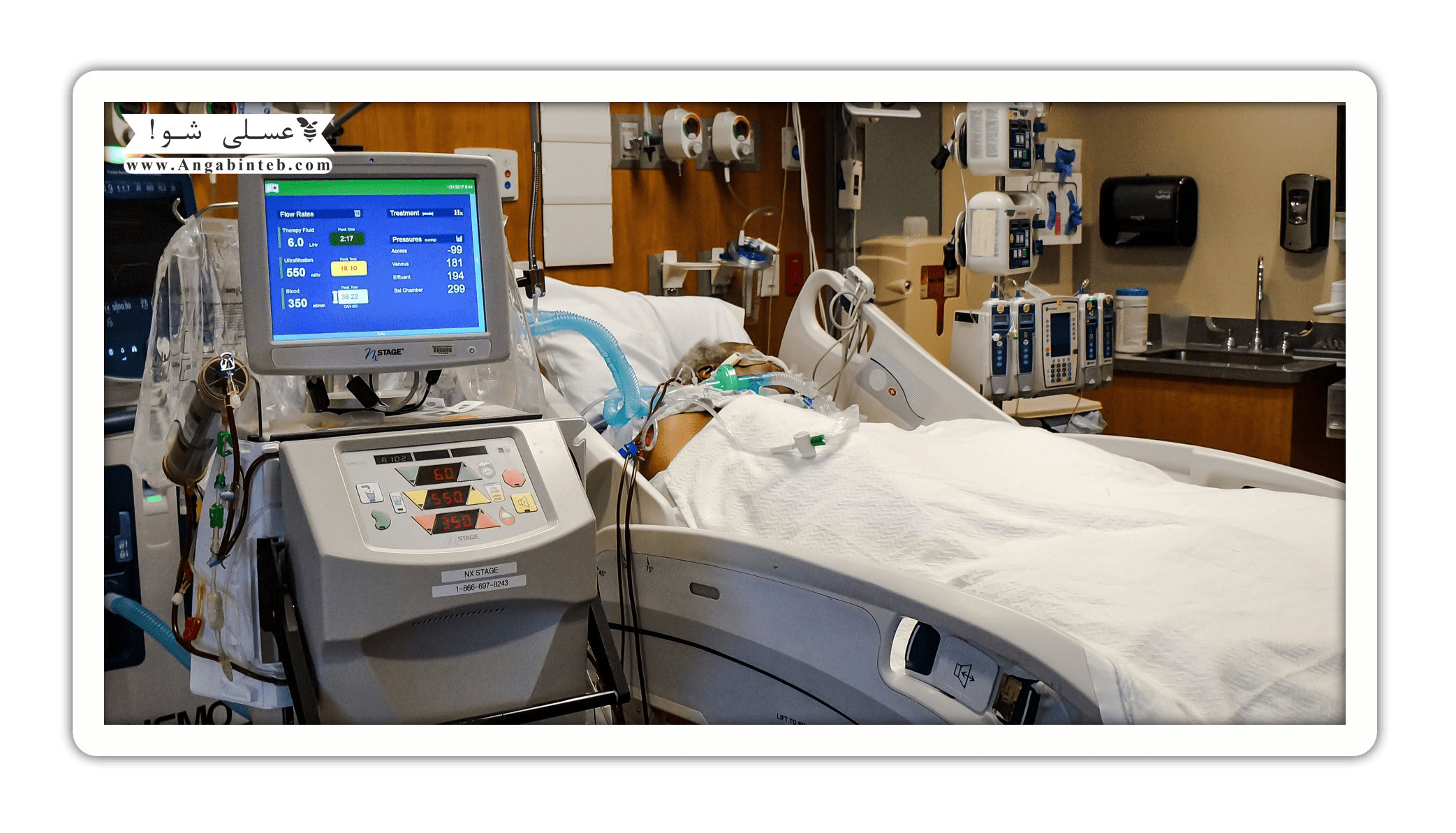 dialysis-how