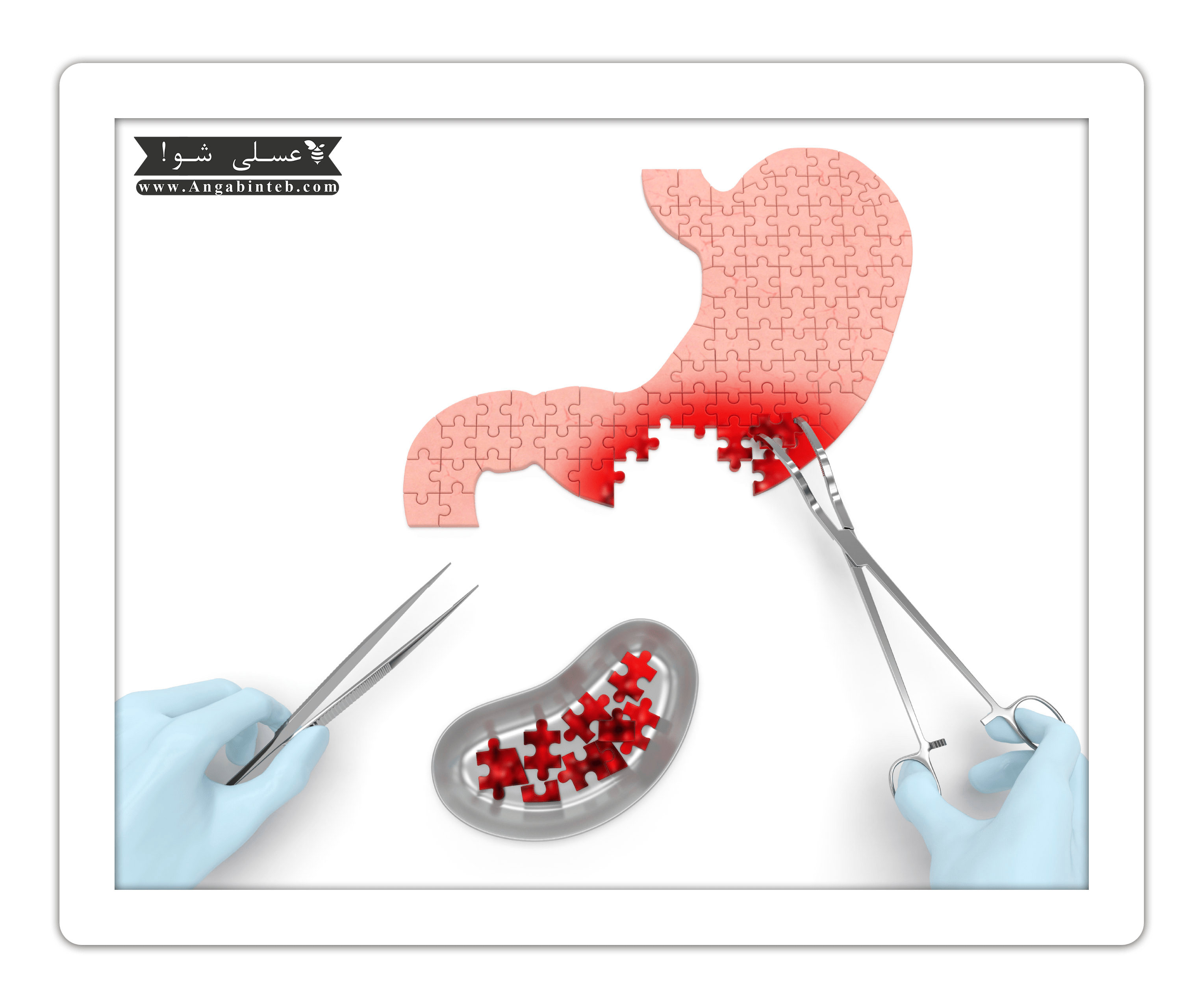 Cancer-treatment-min