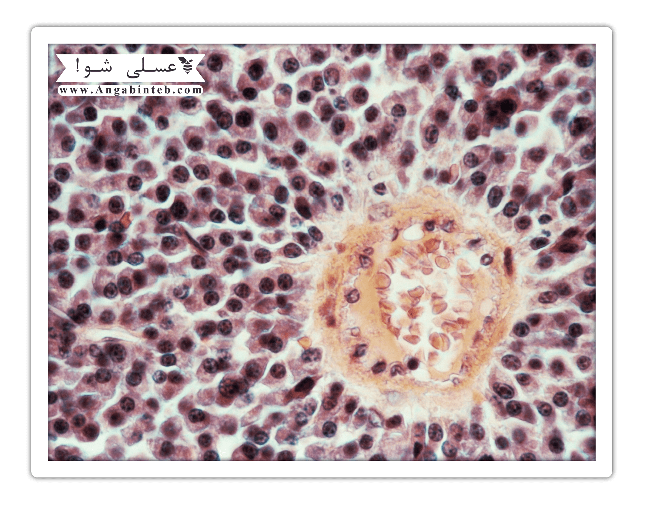 chemotherapy-myelosuppression-min