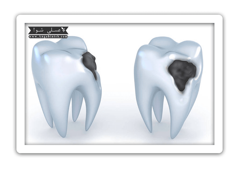 OralHealth-Poosidegi-min