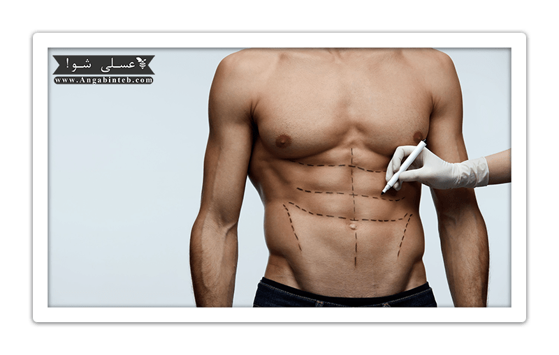 Bodyjet-Liposuction-min