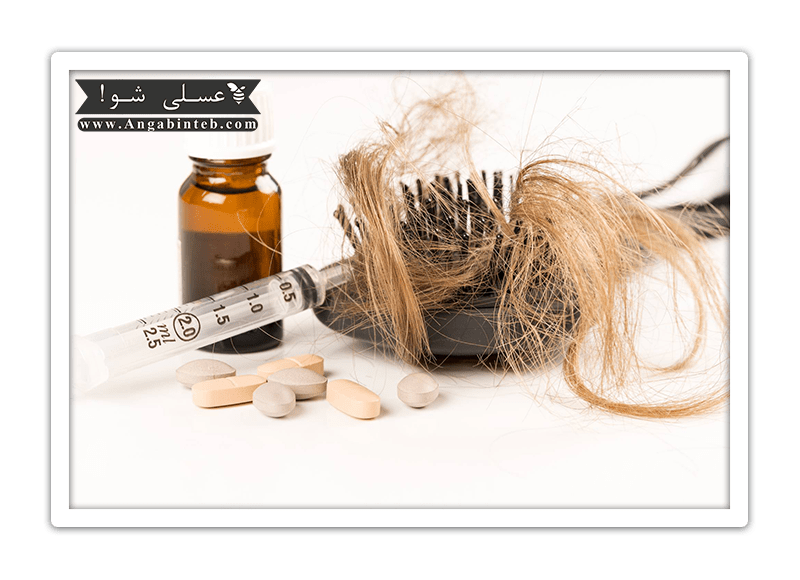 HairLoss-Treatment-min