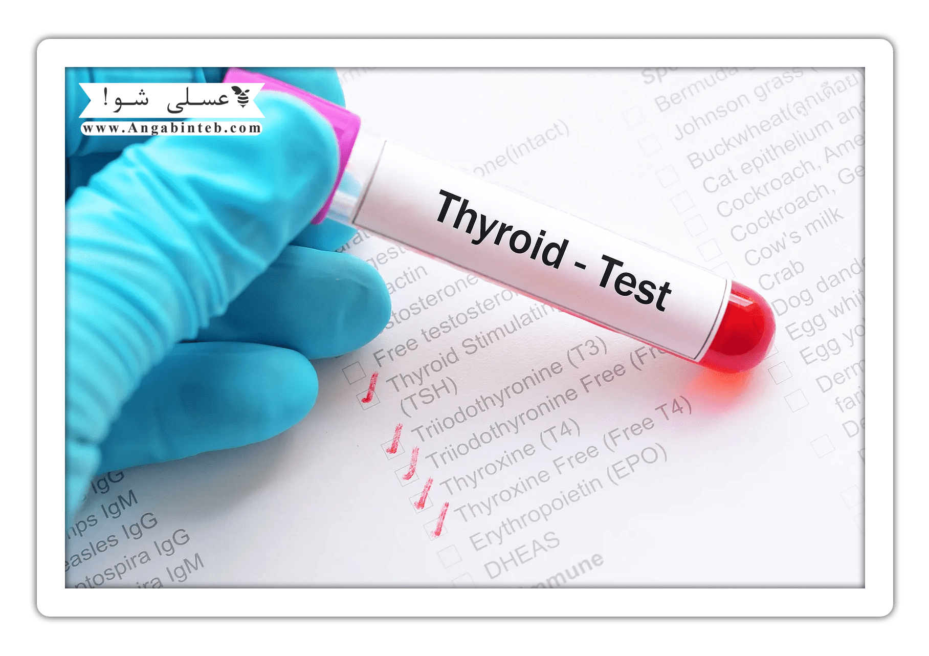 Hyperthyroidism%20-%203-min.png