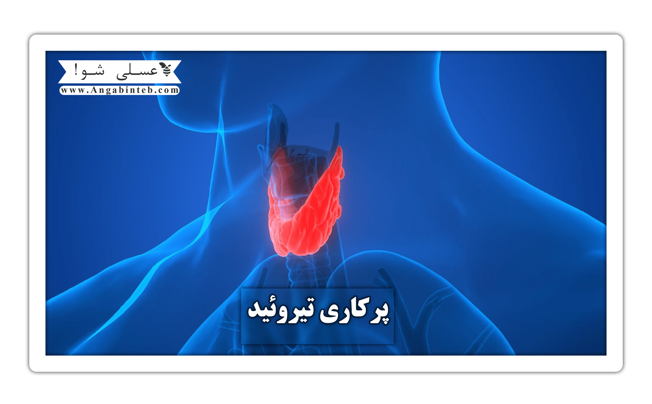 Hyperthyroidism%20-%20main-min.png