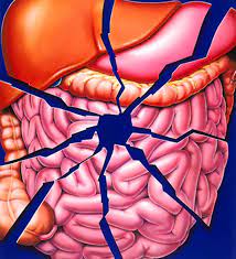 Abdominal trauma