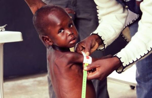  Assess the severity of malnutrition