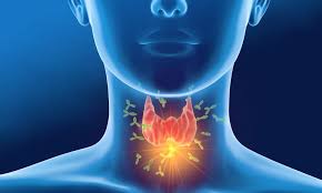 Nutrition in Thyroid Disease